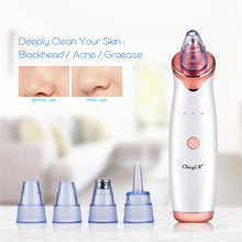 Load image into Gallery viewer, Electric Blackhead remover &amp; Pore Cleanser
